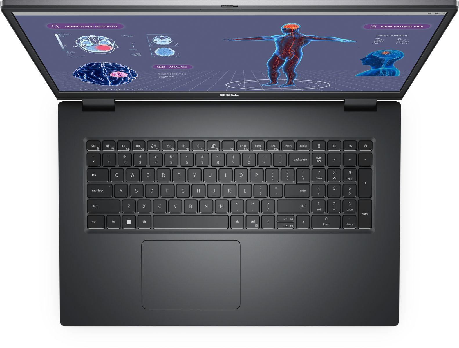 DELL Precision 7780 Intel Core i7 i7-13850HX Workstation mobile 43,9 cm (17.3") Full HD 32 GB DDR5-SDRAM 1 TB SSD NVIDIA RTX 3500 Ada Wi-Fi 6E (802.11ax) Windows 11 Pro Grigio [RVYWV]
